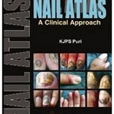 Nail Atlas: A Clinical Approach