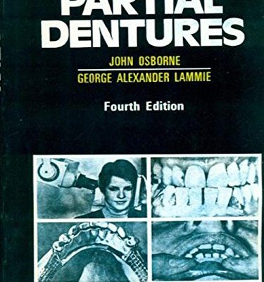 Partial Dentures