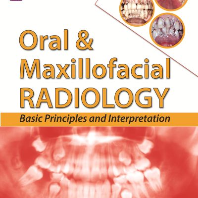 Oral & Maxillofacial Radiology Basic Principles And Interpretation