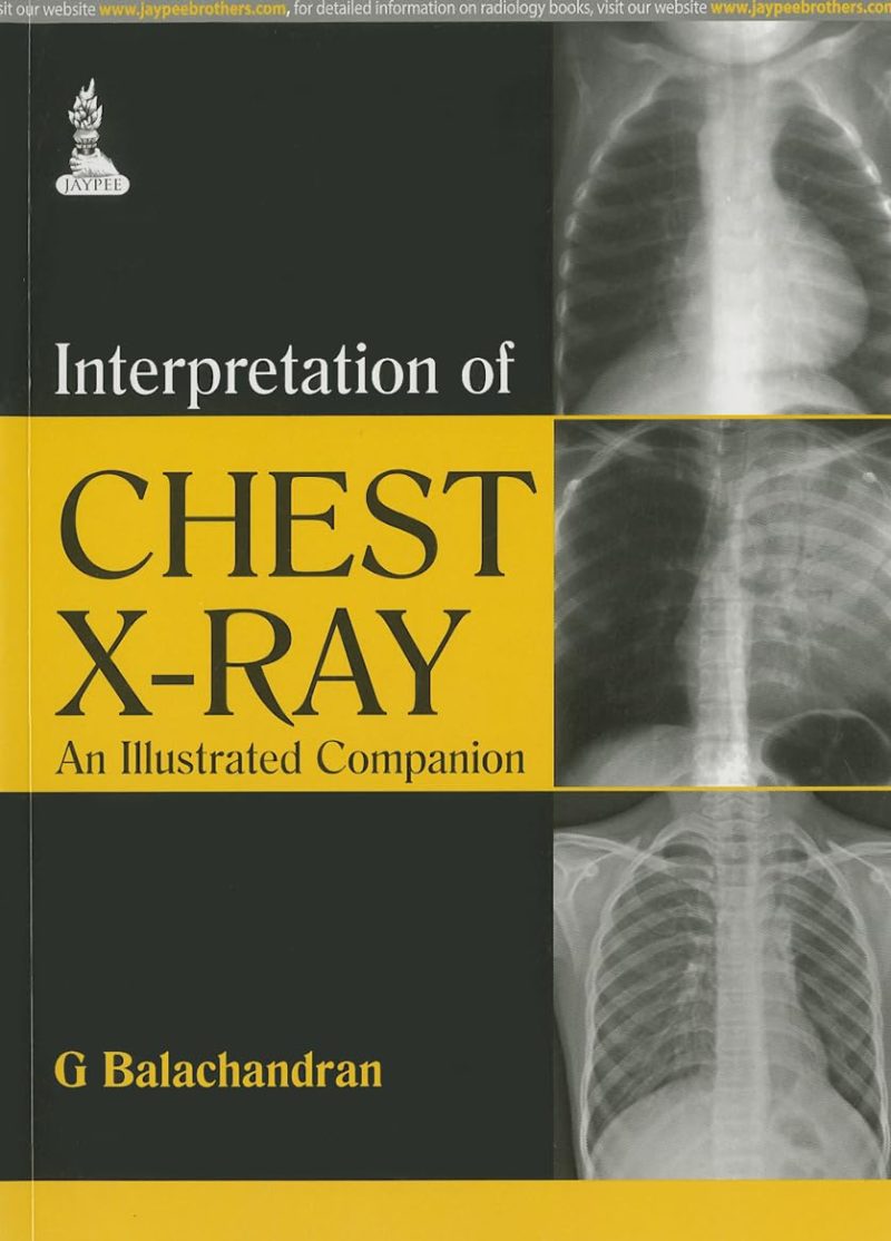 Interpretation Of Chest X-Ray An Illustrated Companion
