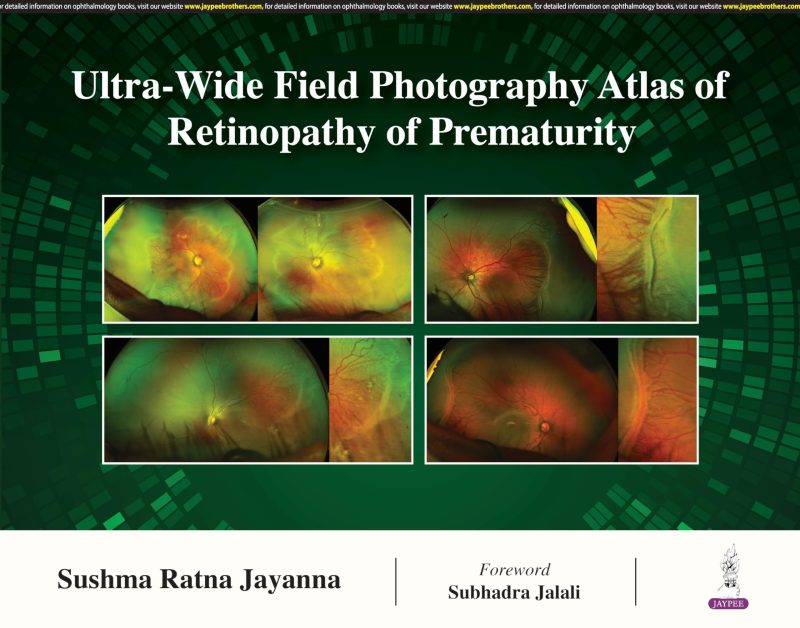 Ultra- Wide Field Photography Atlas Of Retinopathy Of Prematurity