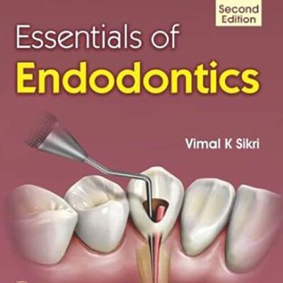 ESSENTIALS OF ENDODONTICS 2ED (PB 2019) [Paperback] SIKRI V.K