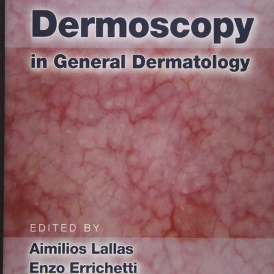 Dermoscopy in General Dermatology