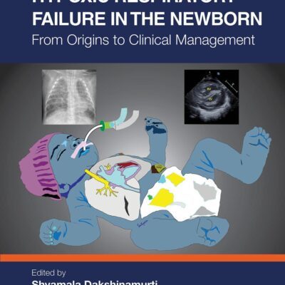 Hypoxic Respiratory Failure in the Newborn