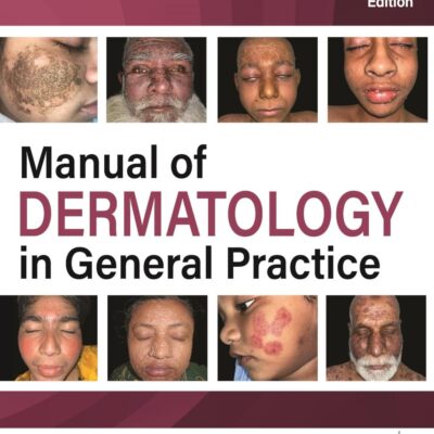 Manual of Dermatology in General Practice