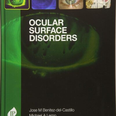 Ocular Surface Disorders