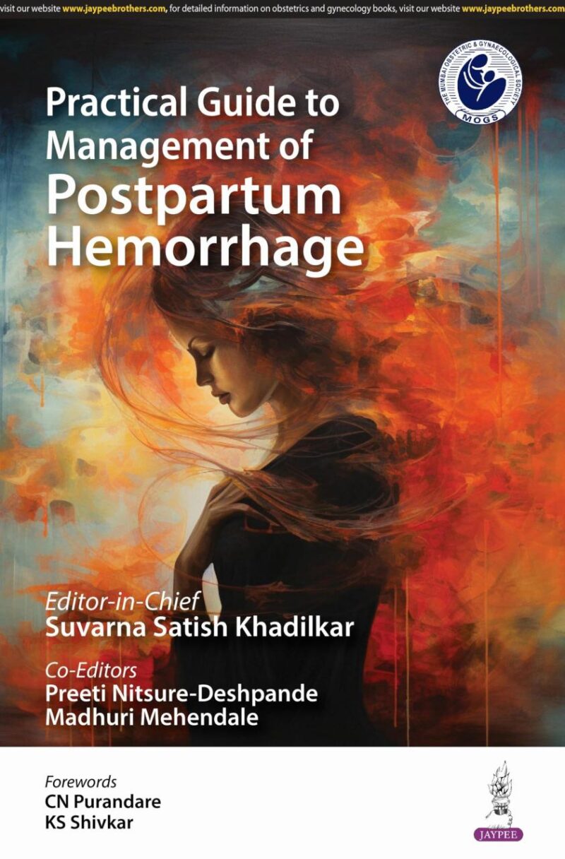 Practical Guide to Management of Postpartum Hemorrhage
