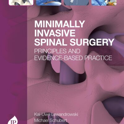 Minimally Invasive Spinal Surgery: Principles and Evidence-Based Practice