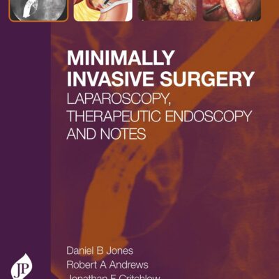 Minimally Invasive Surgery: Laparoscopy