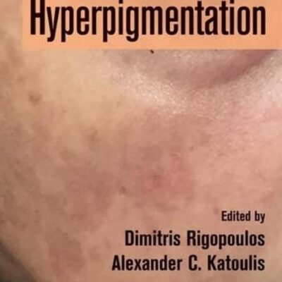 Hyperpigmentation (Hb 2018)
