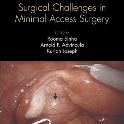 FIBROID UTERUS SURGICAL CHALLENGES IN MINIMAL ACCESS SURGERY (HB 2021)