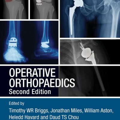 Operative Orthopaedics 2Ed (Pb 2021)