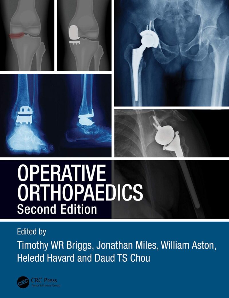 Operative Orthopaedics 2Ed (Pb 2021)