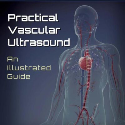 PRACTICAL VASCULAR ULTRASOUND AN ILLUSTRATED GUIDE (PB 2014)