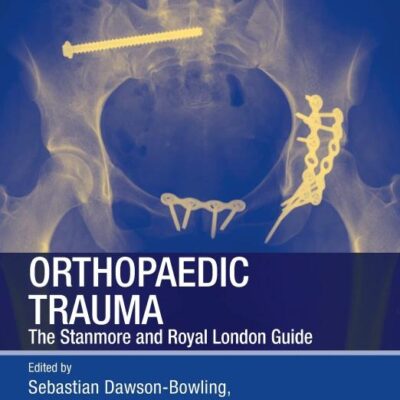 ORTHOPAEDIC TRAUMA THE STANMORE AND ROYAL LONDON GUIDE (PB 2015)