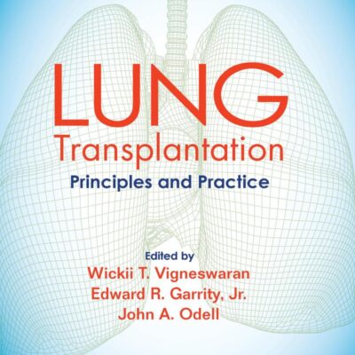 Lung Transplantation: Principles and Practice
