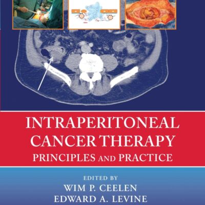 Intraperitoneal Cancer Therapy Principles And Practice (Pb 2020)