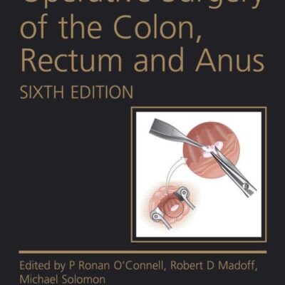 OPERATIVE SURGERY OF THE COLON