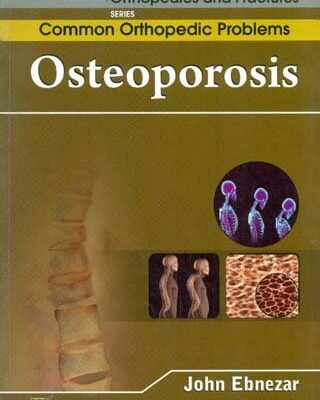 OSTEOPOROSIS (HANDBOOKS IN ORTHOPEDICS AND FRACTURES SERIES