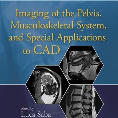Imaging of the Pelvis