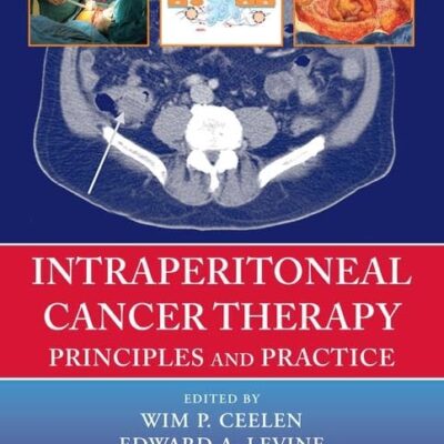 Intraperitoneal Cancer Therapy: Principles and Practice